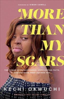 Cover image for More Than My Scars, isbn: 9781540902054